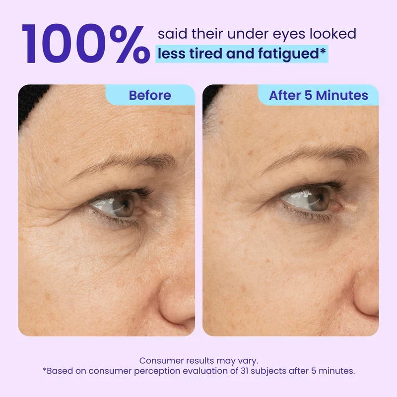 TOPSPIRE Instant Lift Eye Gel