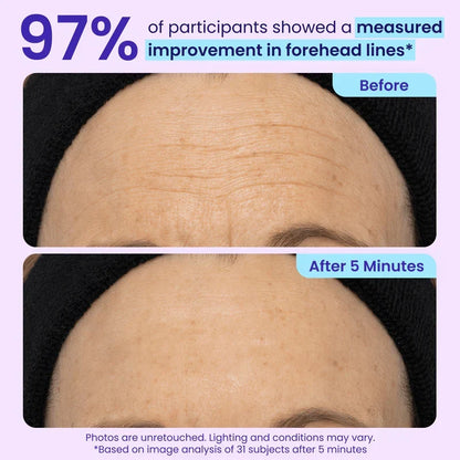 TOPSPIRE Instant Lift Eye Gel