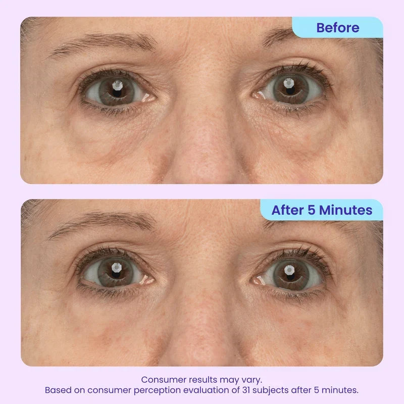 TOPSPIRE Instant Lift Eye Gel