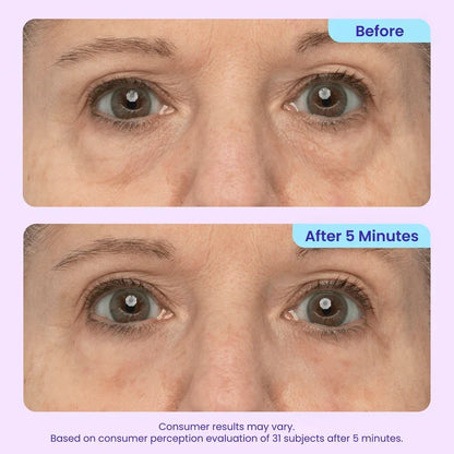 TOPSPIRE Instant Lift Eye Gel