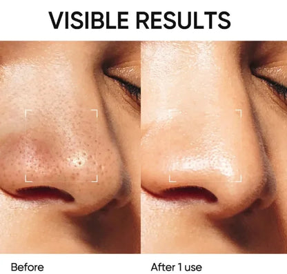 TopSpire Pore Detox Clay Stick✨