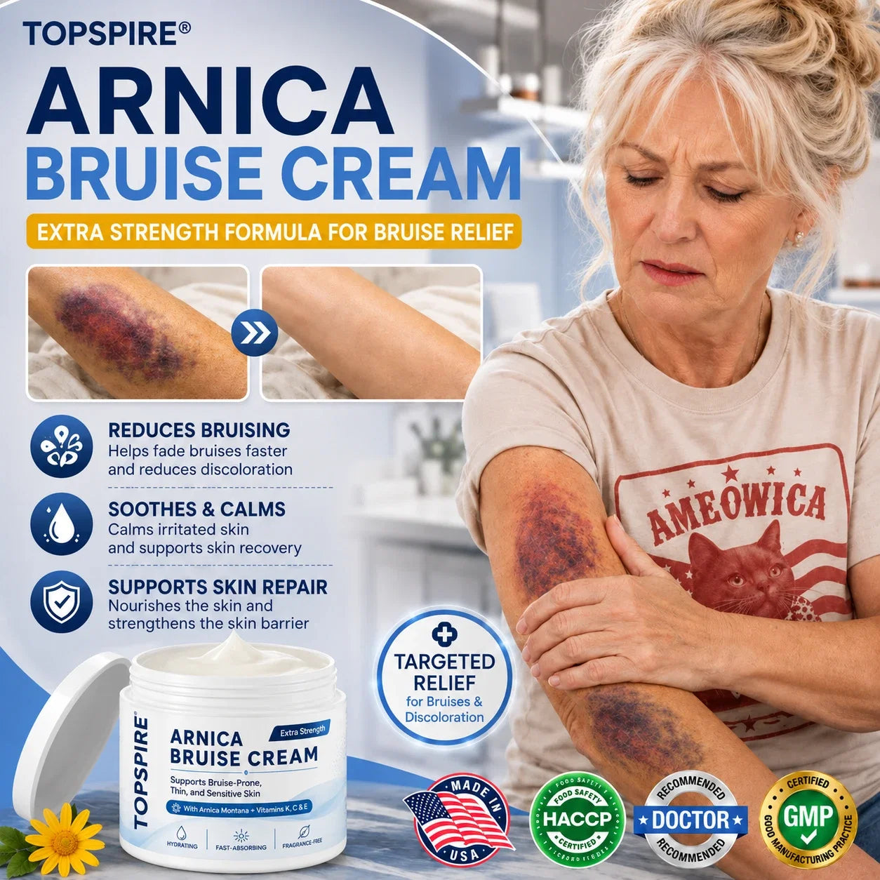 💥100K+ SOLD💕 TOPSPIRE® Arnica Bruise Cream - Repair Bruises & Strengthen Fragile Skin
