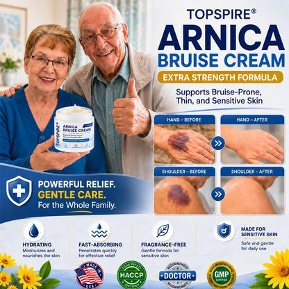 💥100K+ SOLD💕 TOPSPIRE® Arnica Bruise Cream - Repair Bruises & Strengthen Fragile Skin