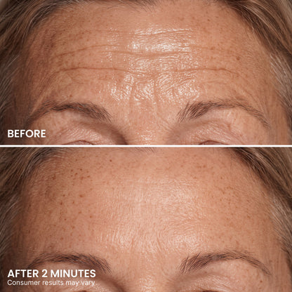 🌸Topspire Instant Eye Tightener – New Formula, Ultimate Lift & Smooth Finish ✨