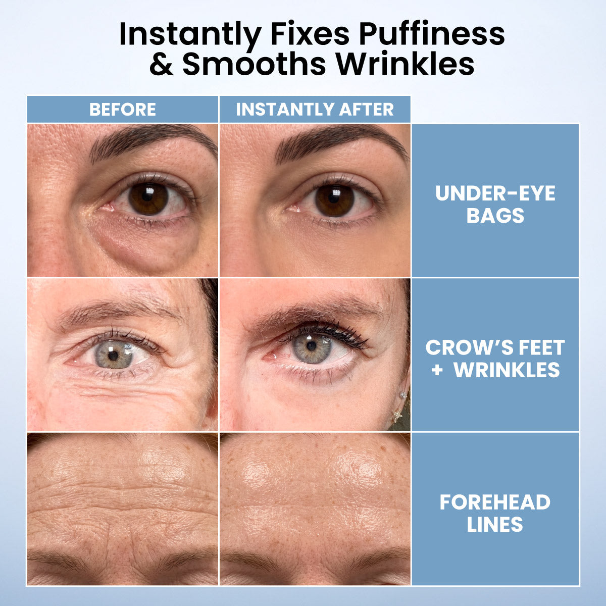🌸Topspire Instant Eye Tightener – New Formula, Ultimate Lift & Smooth Finish ✨