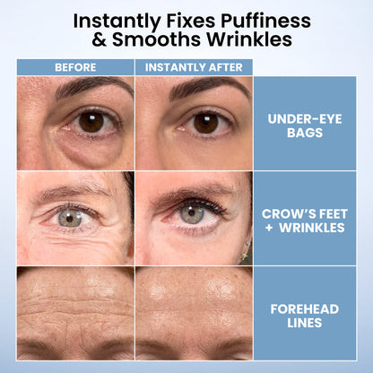🌸Topspire Instant Eye Tightener – New Formula, Ultimate Lift & Smooth Finish ✨