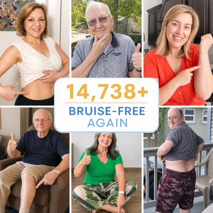 💥100K+ SOLD💕 TOPSPIRE® Arnica Bruise Cream - Repair Bruises & Strengthen Fragile Skin