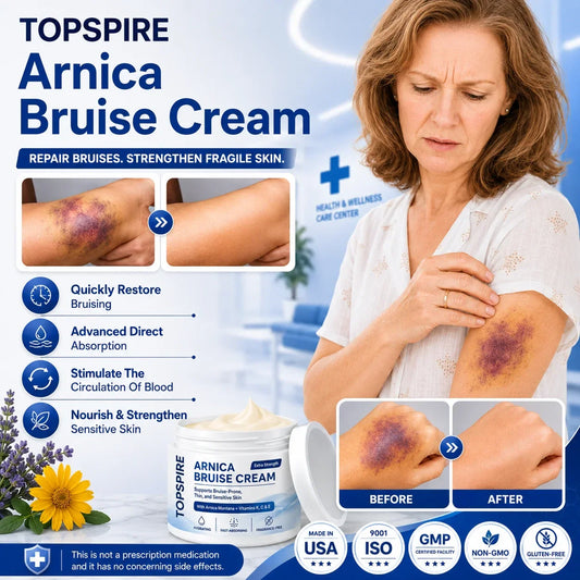 💥100K+ SOLD💕 TOPSPIRE® Arnica Bruise Cream - Repair Bruises & Strengthen Fragile Skin